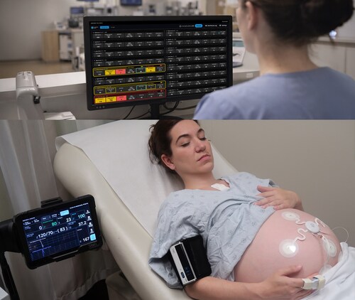 Wireless Maternal Monitoring Introduces Safer And Flexible Maternity&nbsp;Care