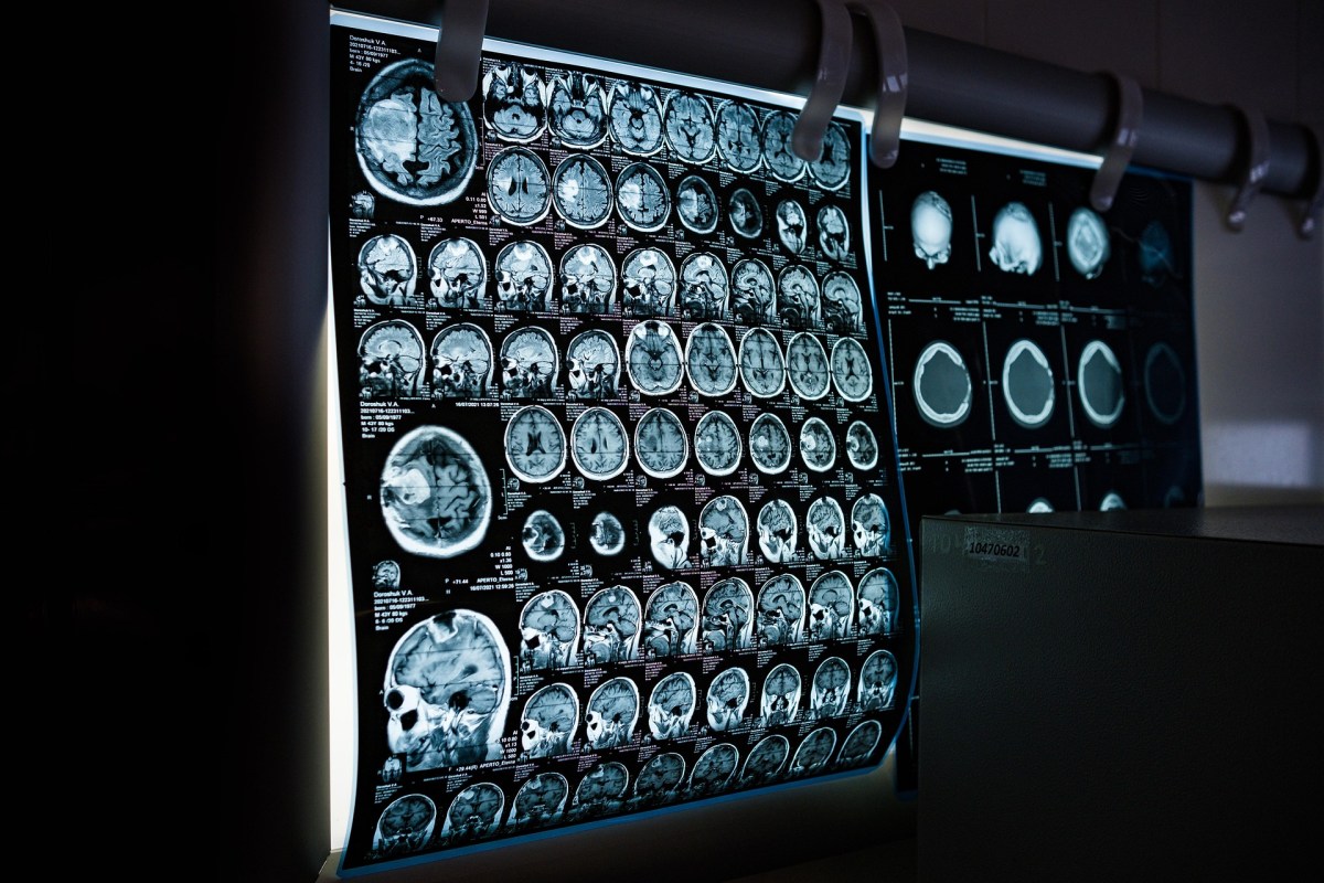 Government Fast-Tracks Motor Neurone Disease Support as National Care Service Takes Shape